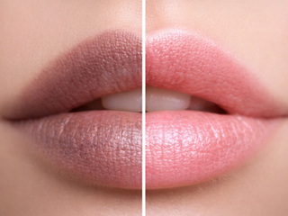 Dark Lips? Here’s How SPF Lip Balm Helps Prevent Pigmentation